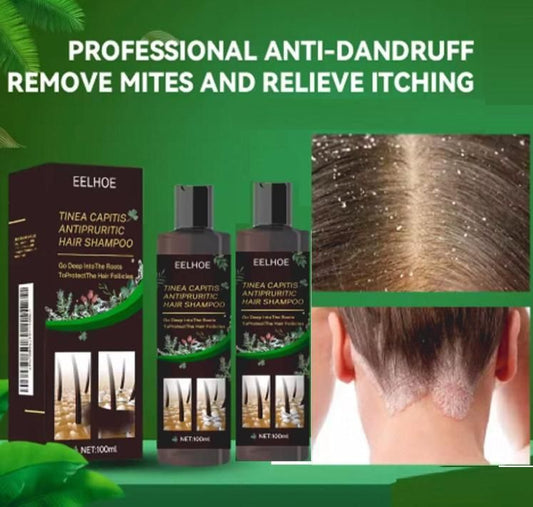 Tinea Capitis Antipruritic Hair Shampoo 100ml Each (Pack of 2)
